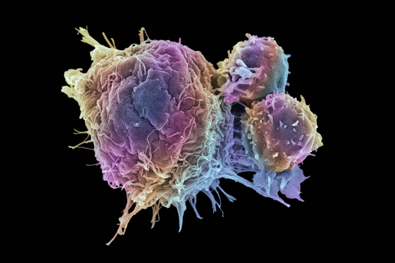 THE SMARTEST UNITS, CANCER CELLS - Scientia Magazine