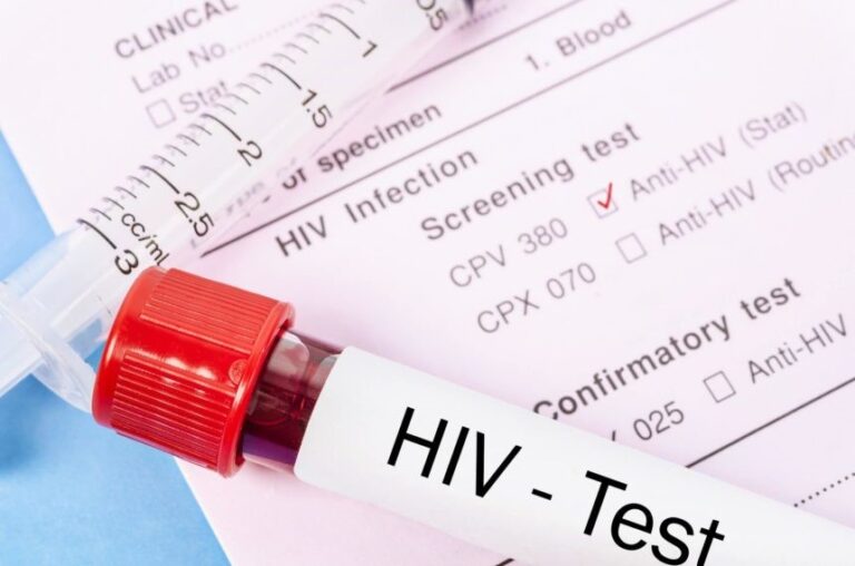 HIV in Pakistan – An alarming Threat