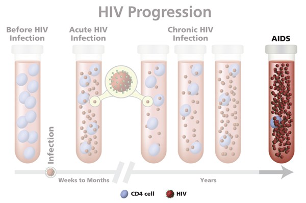 There are several stages in HIV infection. Source: NIH