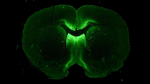 3DI neuronal cells cultured in microgravity for Neuronix, which tests a gene therapy for neurological diseases. MEDIA CREDIT: Image courtesy of Axonis Therapeutics, Inc.